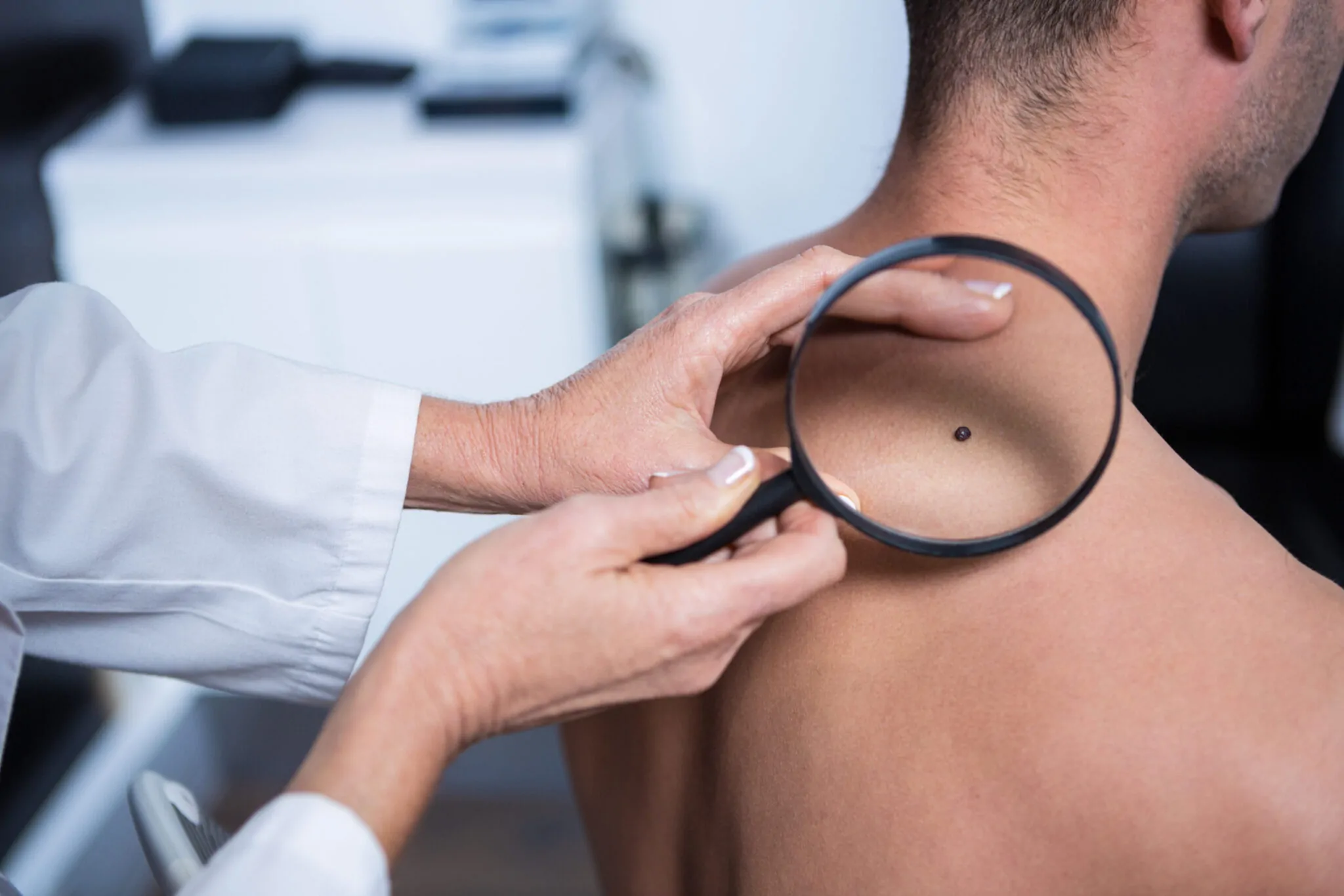 Melanoma and Veterans Disability