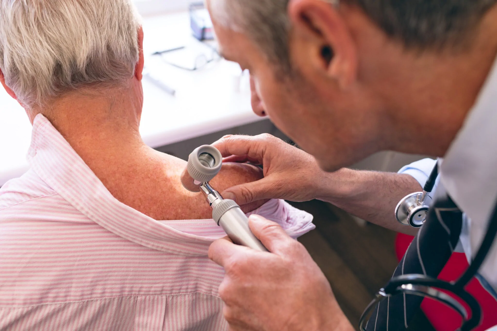 C&P Exam for Skin Cancer