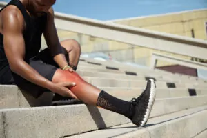 Shin Splints and VA Disability