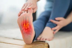 plantar fasciitis va rating