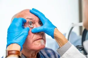 Cataracts and VA Disability