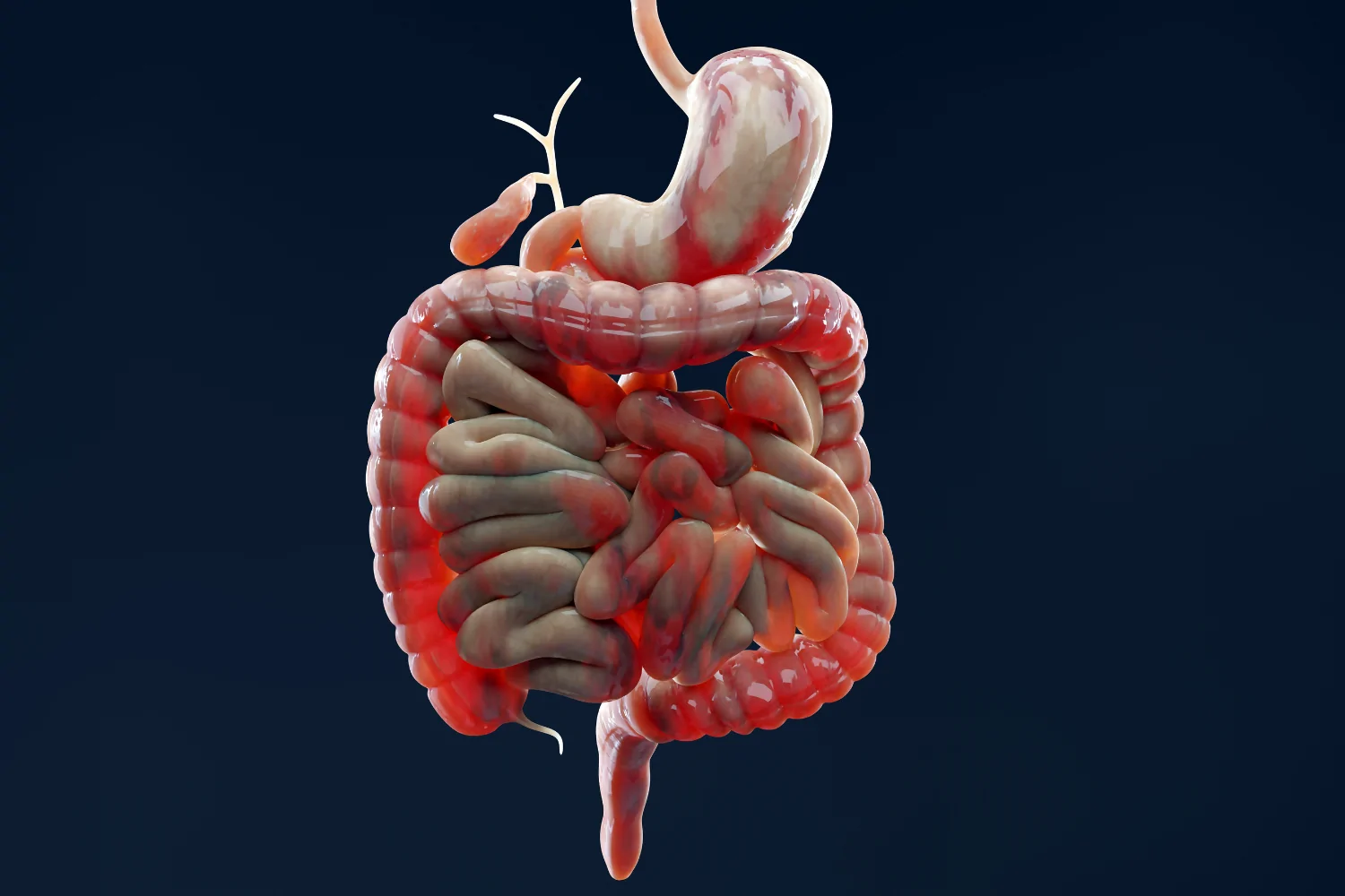 Irritable bowel syndrome IBS VA Rating