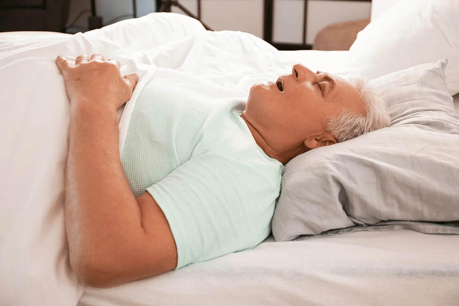 VA Sleep Apnea Rating Criteria (DC 6847)