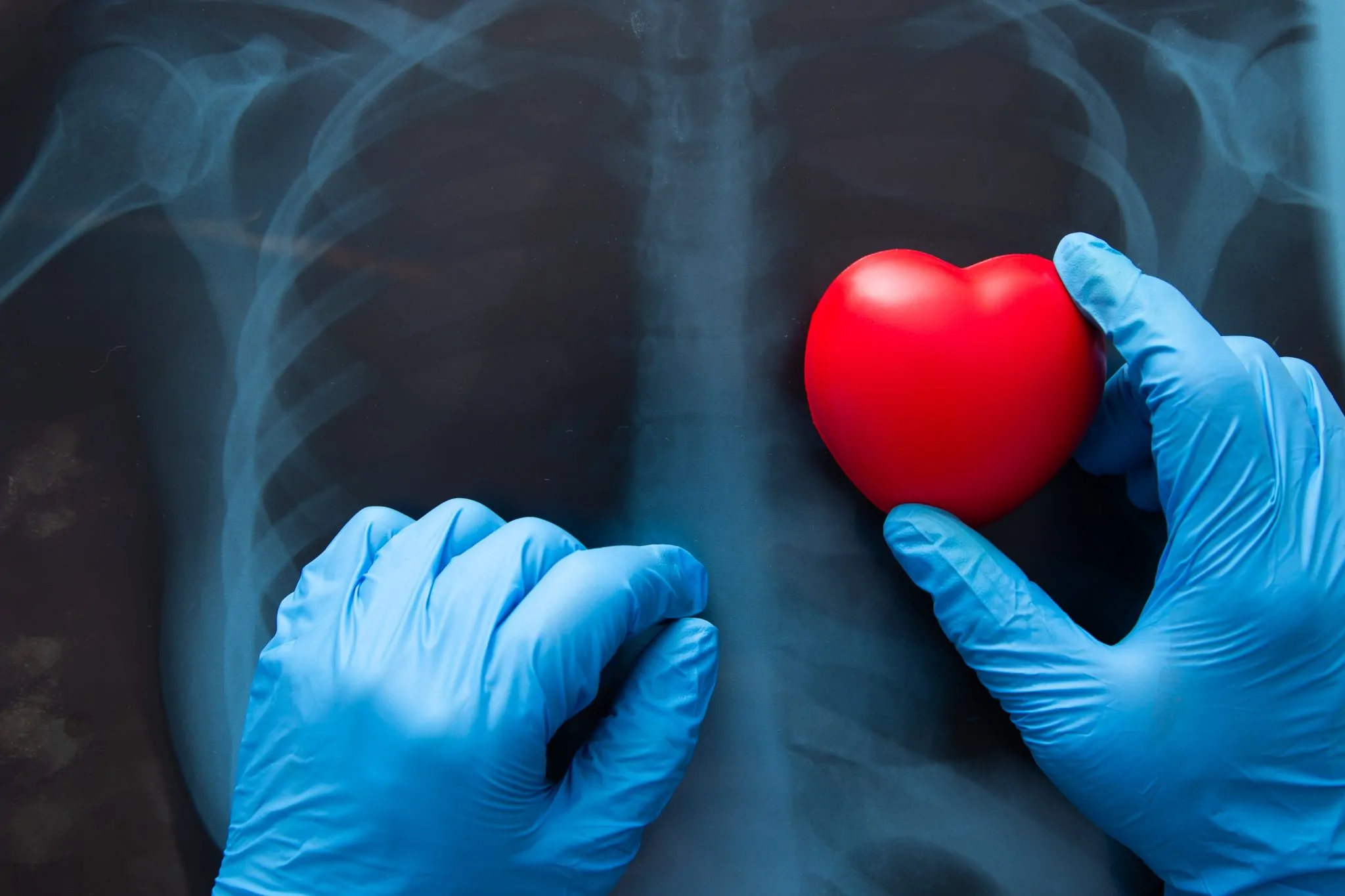 VA METs Test Results Explained for Cardiac Disability Claims